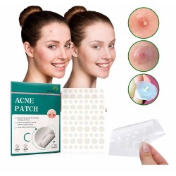 Parches de Acné 72pcs 5682