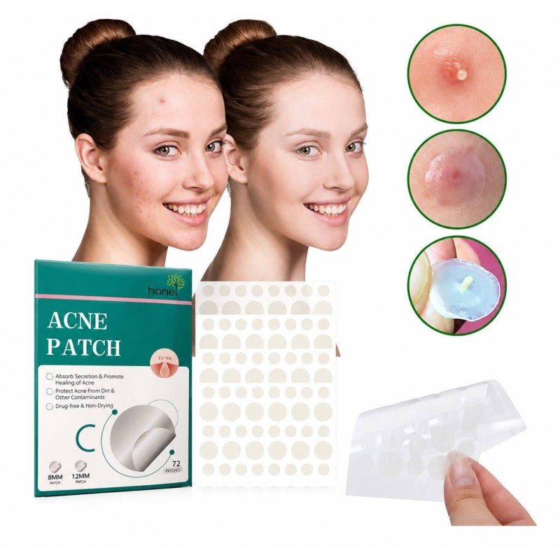 Parches de Acné 72pcs 5682
