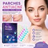 Parches de Acné 180pcs 5683