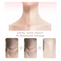 Masajeador Facial Led para Rostro y Cuello 7940